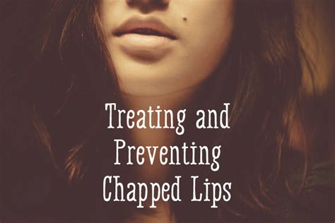 How To Treat And Prevent Chapped Lips Bellatory