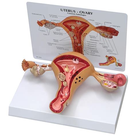 Wie die hysterektomie einzustufen ist. Gebärmutter Eierstockmodell | lebensgroß | AnatomyOnline