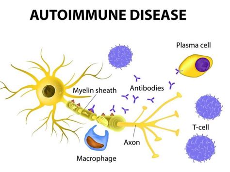 11 Effective Home Remedies For Autoimmune Diseases Organic Facts