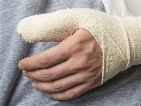 Broken thumb: Signs, symptoms, and treatment