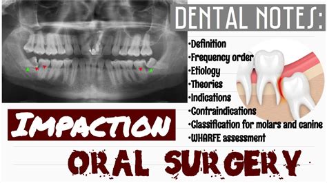 Impaction Oral Surgery Dental Notes Youtube