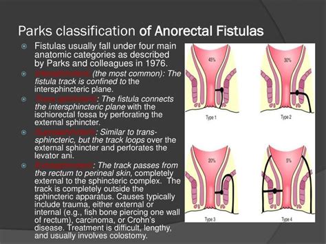 Ppt The Anus And Rectum Powerpoint Presentation Id 369392