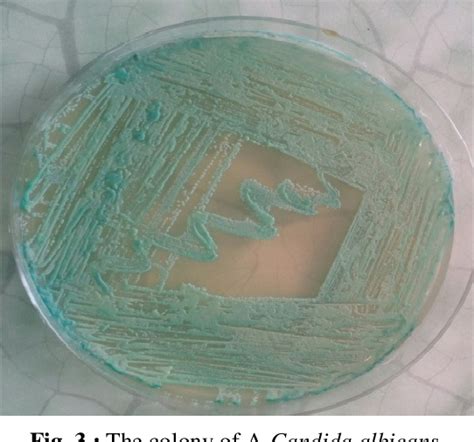Figure 3 From Phenotypic And Genotypic Diagnosis Of Candida Albicans