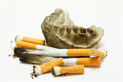 7 dental health concerns for smokers your dentistry guide