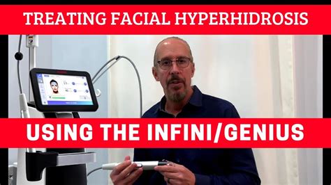 Treating Facial Hyperhidrosis Using The Infinigeniusrf Microneedling