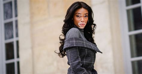 Dont Tell Model Winnie Harlow Shes Suffering From