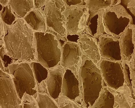 It can be tough, flexible, and sometimes rigid. Plant Parenchyma Cellulose Walls Photograph by Dennis ...