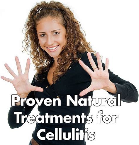 10 Proven Natural Treatments For Cellulitis Healthy Focus