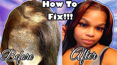 How To Fix A Bald Spot On Wig Vlogmas Day 13 Youtube