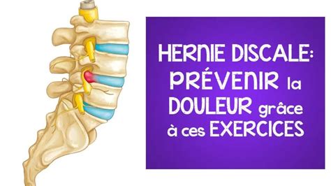 Hernie discale prévenir la douleur grâce à ces exercices lombalgie