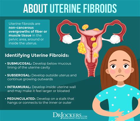 Uterine Fibroids Causes