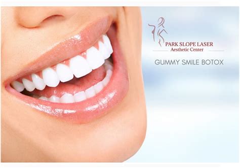 Non Surgical Gummy Smile Treatment Brooklyn Ny Park Slope Brooklyn Ny Park Slope Laser