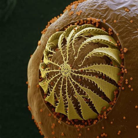 Eyeofscience On Instagram Spore Capsule Of Funaria Hygrometrica A