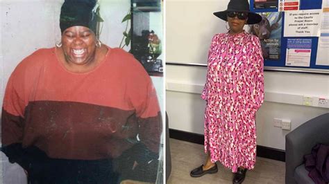Woman Sheds Half Her Body Weight Again After Losing Sight