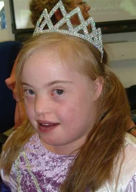 Pin On Downs Syndrome In The News