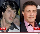 Sylvester Stallone Plastic Surgery Before and After