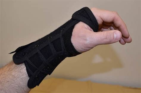 Radial Nerve Palsy Wrist Drop Neuromuscular And Electrodiagnostic