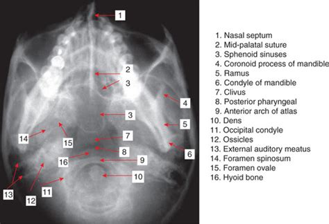 Dental Radiographic Anatomy