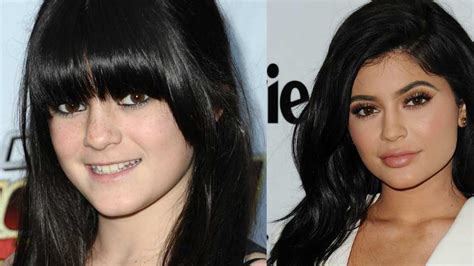 Kylie jenner has basically grown up before our very eyes, which means it's hard not to notice the drastic changes in her look over the past 11 years. Kylie Jenner plastic surgery timeline - before and after ...