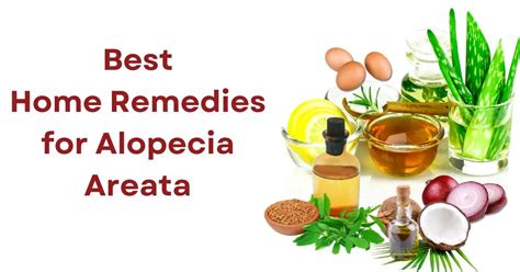 Best 12 Natural Home Remedies For Alopecia Areata Swh