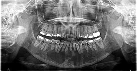 Case Of The Month Uw School Of Dentistry