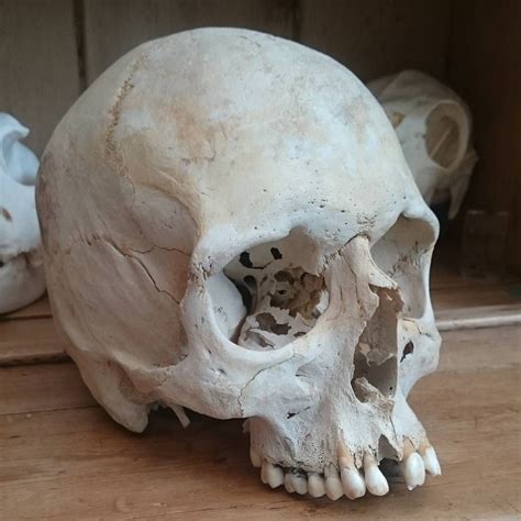 Pin By Jerome Slivensky On Skulls Skull Reference Real Human Skull Skull Anatomy