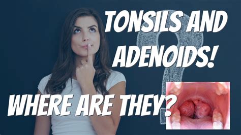 Where Are The Tonsils And Adenoids Youtube