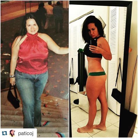 Pin On Before And After Weight Loss Transformation Stories