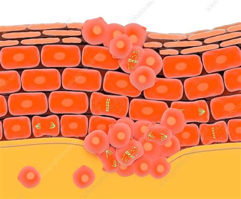 Cell Division During Skin Cancer Stock Image C0238585 Science