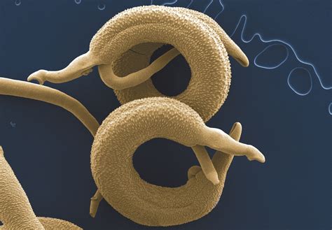 Helminths Parasitic Worm And How They Affect You