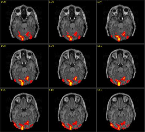 What Is An Fmri Scan And How Does It Work Gambaran
