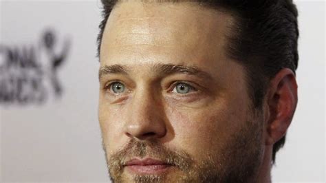 На пути к успеху елена карневская. Jason Priestley Nose Job