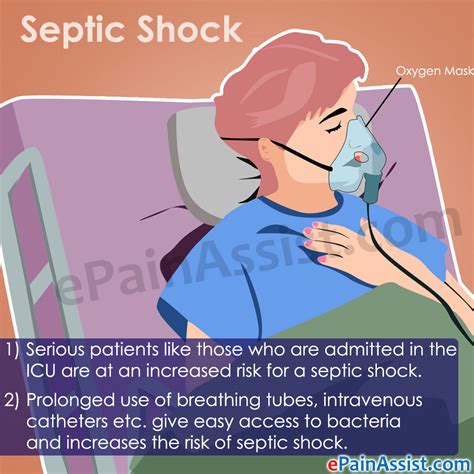 Septic Shock Treatment Signs Symptoms Causes Risk Factors