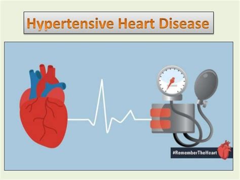 The Progression Of Hypertensive Heart Diseasefrom Hypertension To He