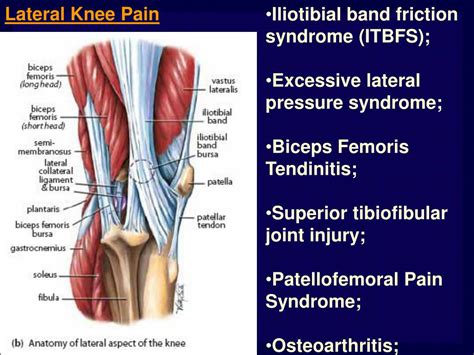 Ppt Lateral Medial And Posterior Knee Pain Powerpoint Presentation