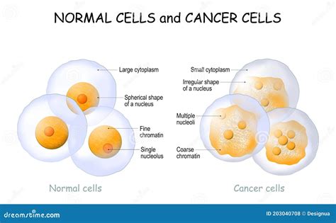 Cancer Cells And Normal Cells Comparison And Difference Stock Vector