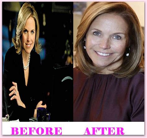 katie couric plastic surgery before and after katiecouricplasticsurgery katiecouric