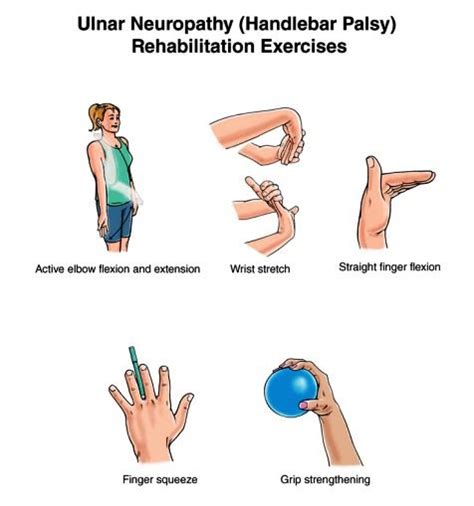 Samarpan Physiotherapy Clinic Ulner Nerve Injury And Physiotherapy