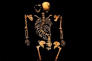Richard III skeleton - Richard III. Photo (35424156) - Fanpop