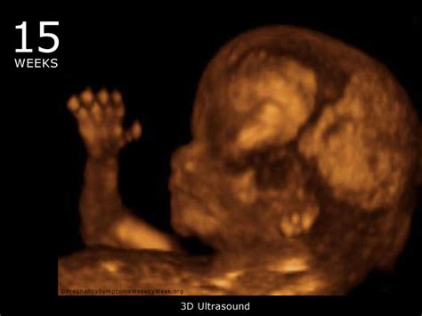 What To Expect In Ultrasound Done At 15 Weeks Pregnant Babiekids