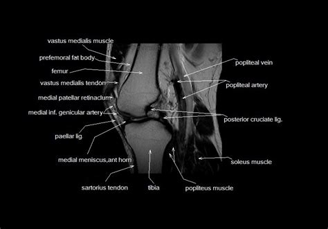 Knee Muscle Anatomy Mri These Are Essential Structures To Evaluate In