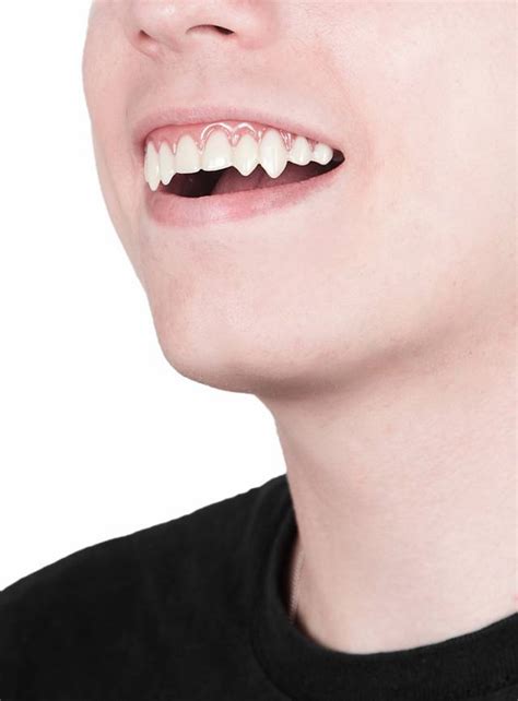 Dental Fx Vampire Teeth