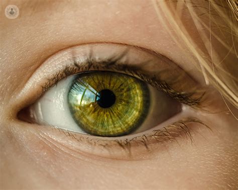 Glaucoma Ocular Tipos Y Tratamiento Top Doctors