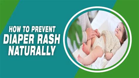 Prevent Diaper Rash Naturally Power Strategies