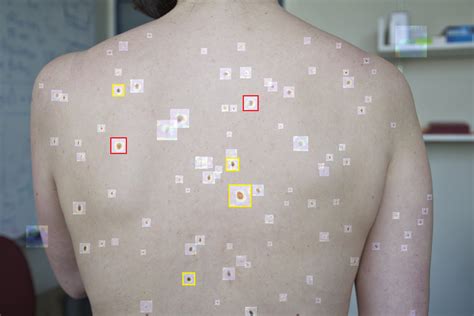 What Skin Cancer Can Look Like Do You Know How To Identify Early