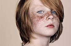 freckles beautiful freckled elbank brock portrait people portraits beauty redheads photography women heavily faces pictured denny mckeon looking boy taches