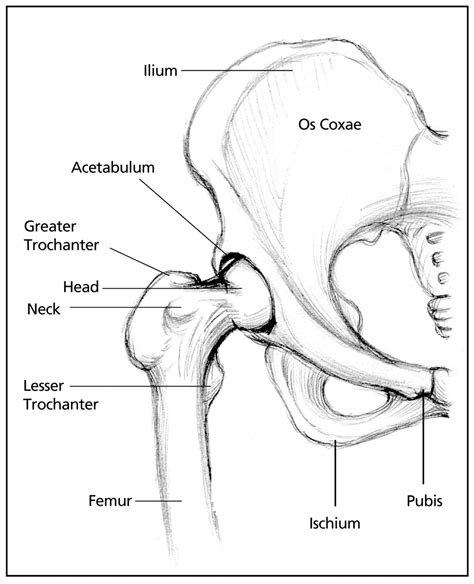 The lesser trochanter (trochanter minor; Snapping Hip Syndrome: What Is That Weird Pop?