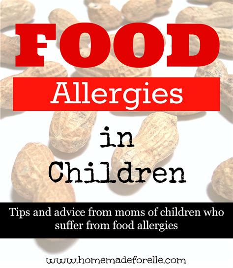 Food Allergies In Children Tips