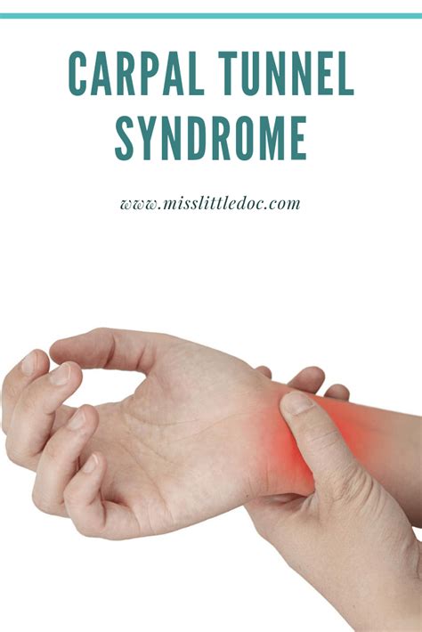 Carpal Tunnel Syndrome ⋆