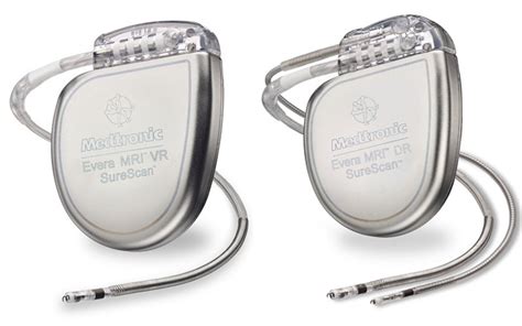 If your arrhythmia is serious, you may need a cardiac pacemaker or an implantable cardioverter defibrillator (icd). Medtronic's Evera MRI(TM) SureScan ICD System is first to ...